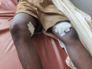 MMG Kinsevere : Deux creuseurs blessés par balle vivants mais livrés à eux mêmes